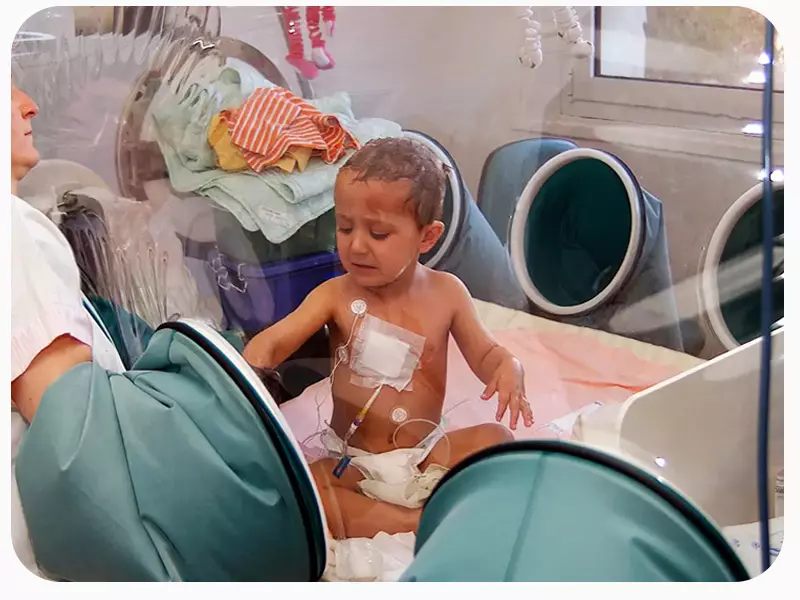 کودک متولد شده با بیماری نقص ایمنی مرکب شدید