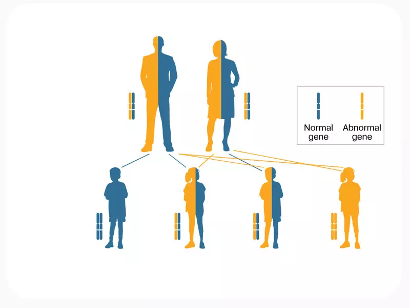 کروموزم در بیماری نقص ایمنی مرکب شدید