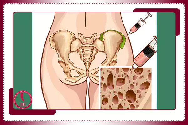 طول عمر بیماران نقص ایمنی با پیوند مغز استخوان