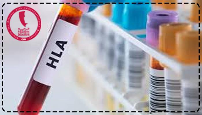 آزمایش hla کجا انجام میشود