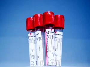 خواندن آزمایش HLA