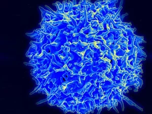 سندروم هایپر IgM