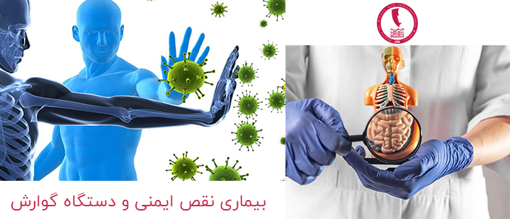 درباره بیماری نقص ایمنی و دستگاه گوارش