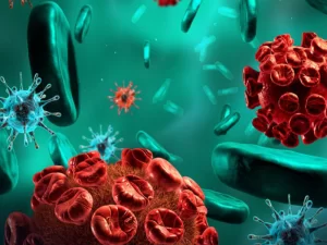 نقص ایمنی و عفونت