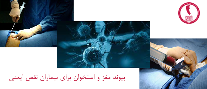 پیوند مغز و استخوان برای بیماران نقص ایمنی