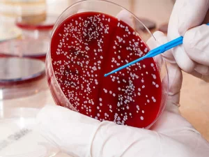 کاربردهای پیوند مغز استخوان در نقص ایمنی