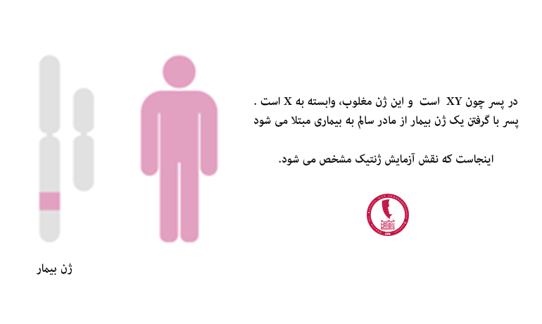 آگاماگلوبولینمی در پسران