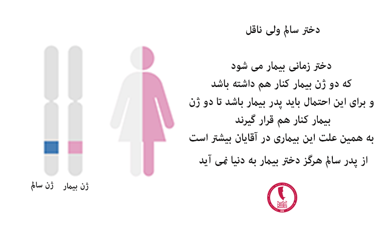 آگاماگلوبولینمی در دختران