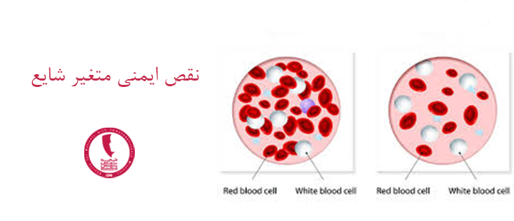نقص ایمنی متغیر شایع چیست؟