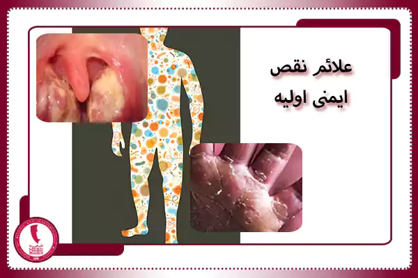 علائم نقص ایمنی اولیه