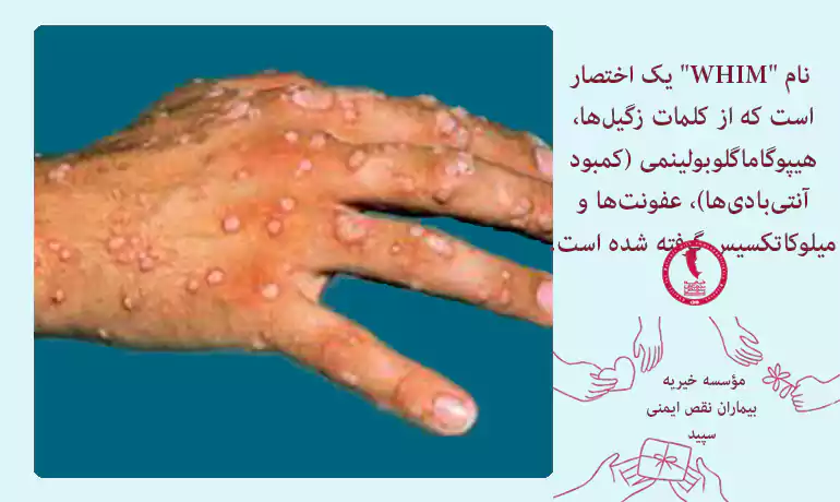 WHIM یک بیماری نقص ایمنی