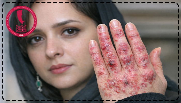 سندرم درس ترانه علیدوستی